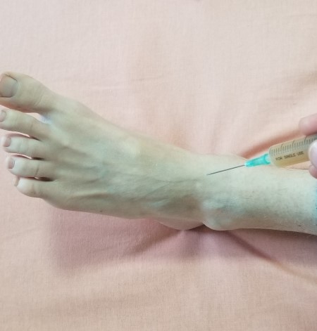 Inject Ankle NB