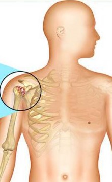 Shoulder (2)